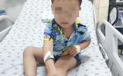 Bé trai bị rắn lục cắn Bé trai bị rắn lục cắn