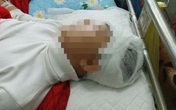 Đã có kết quả giám định nam sinh lớp 11 bị bạn đánh vỡ sọ não Đã có kết quả giám định nam sinh lớp 11 bị bạn đánh vỡ sọ não