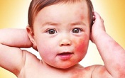 Bác sĩ hướng dẫn trị bệnh nhiều trẻ mắc mùa đông xuân hiệu quả tại nhà Bác sĩ hướng dẫn trị bệnh nhiều trẻ mắc mùa đông xuân hiệu quả tại nhà