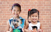 Để tiếng cười trọn vẹn thành hiện thực cho trẻ em hở môi, hàm ếch Để tiếng cười trọn vẹn thành hiện thực cho trẻ em hở môi, hàm ếch