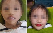 Lộ danh tính người phun môi cho bé gái 5 tuổi, biết sự thật dư luận càng phẫn nộ Lộ danh tính người phun môi cho bé gái 5 tuổi, biết sự thật dư luận càng phẫn nộ