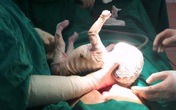 Cô gái 15 tuổi sinh con toàn thân bọc vảy trắng, da nứt nẻ, chảy máu Cô gái 15 tuổi sinh con toàn thân bọc vảy trắng, da nứt nẻ, chảy máu