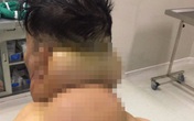 Người đàn ông bị biến dạng cơ thể do uống nhiều rượu Người đàn ông bị biến dạng cơ thể do uống nhiều rượu