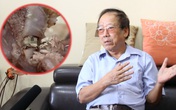 Chuyên gia sinh học và thực phẩm bình luận về thông tin cháo sườn có ổ giòi ở Hà Nội Chuyên gia sinh học và thực phẩm bình luận về thông tin cháo sườn có ổ giòi ở Hà Nội