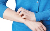 Dấu hiệu trên da cảnh báo nhiều loại ung thư Dấu hiệu trên da cảnh báo nhiều loại ung thư