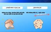 Mất 32 triệu đồng chữa "chuỗi hạt ngọc" vẫn không khỏi Mất 32 triệu đồng chữa "chuỗi hạt ngọc" vẫn không khỏi