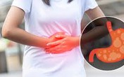 Bài thuốc hay, bổ dưỡng cho hệ tiêu hóa, tiêu chứng đầy bụng, hỗ trợ bảo vệ sức khỏe mùa dịch bệnh Bài thuốc hay, bổ dưỡng cho hệ tiêu hóa, tiêu chứng đầy bụng, hỗ trợ bảo vệ sức khỏe mùa dịch bệnh