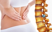 Dấu hiệu nhận biết thoát vị đĩa đệm vùng thắt lưng Dấu hiệu nhận biết thoát vị đĩa đệm vùng thắt lưng