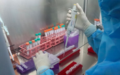 Bộ Y tế thông tin về đột biến gene trên mẫu bệnh phẩm COVID-19 Bộ Y tế thông tin về đột biến gene trên mẫu bệnh phẩm COVID-19