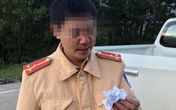"Thông" chốt kiểm dịch, nam thanh niên tấn công Cảnh sát giao thông "Thông" chốt kiểm dịch, nam thanh niên tấn công Cảnh sát giao thông