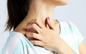 Cải thiện mề đay mạn tính hiệu quả, hạn chế tái phát với giải pháp thảo dược Cải thiện mề đay mạn tính hiệu quả, hạn chế tái phát với giải pháp thảo dược