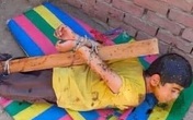 Bé 7 tuổi bị bố phạt trói vào cột, phủ mật cho ong đốt Bé 7 tuổi bị bố phạt trói vào cột, phủ mật cho ong đốt
