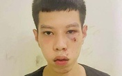 Bắt giữ thanh niên Hà Nội cướp 16 triệu của cụ bà vừa lĩnh lương hưu Bắt giữ thanh niên Hà Nội cướp 16 triệu của cụ bà vừa lĩnh lương hưu