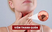Cải thiện viêm thanh quản hiệu quả, an toàn nhờ sản phẩm thảo dược Cải thiện viêm thanh quản hiệu quả, an toàn nhờ sản phẩm thảo dược
