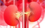 Dùng sản phẩm thảo dược cải thiện suy thận độ 2 - Xu hướng mới được nhiều người lựa chọn Dùng sản phẩm thảo dược cải thiện suy thận độ 2 - Xu hướng mới được nhiều người lựa chọn