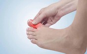 Nếu phát hiện mình bị mắc "gout" hãy làm ngay điều này Nếu phát hiện mình bị mắc "gout" hãy làm ngay điều này