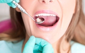 8 quy tắc cần ghi nhớ với răng nhạy cảm 8 quy tắc cần ghi nhớ với răng nhạy cảm