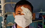 Người đàn ông bị cò mổ thủng mắt trái Người đàn ông bị cò mổ thủng mắt trái