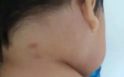 Con trai bị côn trùng cắn lúc ngủ, bố mẹ 'chết lặng' khi bác sĩ báo tin con tử vong để lại bí ẩn chưa ai giải thích được Con trai bị côn trùng cắn lúc ngủ, bố mẹ 'chết lặng' khi bác sĩ báo tin con tử vong để lại bí ẩn chưa ai giải thích được