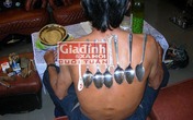 Chuyện khó tin về người đàn ông tự phóng điện, hút kim loại sau trận ốm “thập tử nhất sinh” Chuyện khó tin về người đàn ông tự phóng điện, hút kim loại sau trận ốm “thập tử nhất sinh”