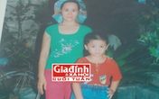 Hành trình chữa bệnh khốn khổ của người phụ nữ có mái tóc “sư tử” Hành trình chữa bệnh khốn khổ của người phụ nữ có mái tóc “sư tử”