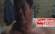 Căn bệnh bí hiểm của người đàn ông có bộ ngực khổng lồ Căn bệnh bí hiểm của người đàn ông có bộ ngực khổng lồ