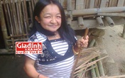 Chuyện buồn của cô gái 24 tuổi phải mang hình hài bà lão Chuyện buồn của cô gái 24 tuổi phải mang hình hài bà lão