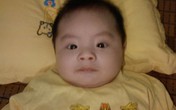 Bé 3 tuổi chống chọi với ung thư máu Bé 3 tuổi chống chọi với ung thư máu