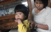 Hy vọng sống ùa đến với cô bé cơ thể cháy đen Hy vọng sống ùa đến với cô bé cơ thể cháy đen