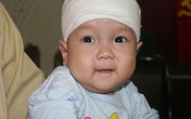 Xót xa những vết loét ngày càng sâu trên đầu bé Vũ Mạnh Tùng Xót xa những vết loét ngày càng sâu trên đầu bé Vũ Mạnh Tùng