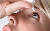 Tai hại khôn lường do dùng thuốc nhỏ mắt kéo dài Tai hại khôn lường do dùng thuốc nhỏ mắt kéo dài