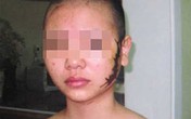 Tòa Vũng Tàu 'sốc' vì vụ thiếu nữ bị xăm rết phải điều tra lại Tòa Vũng Tàu 'sốc' vì vụ thiếu nữ bị xăm rết phải điều tra lại