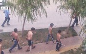 Công nhân gây sự, ông chủ bị tạt a-xít Công nhân gây sự, ông chủ bị tạt a-xít
