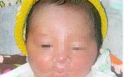 Bé trai sơ sinh không có tay chân Bé trai sơ sinh không có tay chân