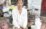 Cuộc sống đói nghèo, lầm lũi của những "dị nhân" Cuộc sống đói nghèo, lầm lũi của những "dị nhân"