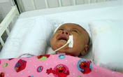 Xót xa bé 3 tháng tuổi chấn thương não vì cha ném xuống đường Xót xa bé 3 tháng tuổi chấn thương não vì cha ném xuống đường
