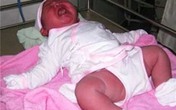 Sản phụ sinh em bé nặng 6kg ở Bình Thuận Sản phụ sinh em bé nặng 6kg ở Bình Thuận