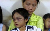Cháu bé 3 tuổi bị bạo hành được mẹ đưa đi trốn? Cháu bé 3 tuổi bị bạo hành được mẹ đưa đi trốn?