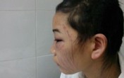 Giây phút tự rạch mặt của người vợ bị chồng bạo hành Giây phút tự rạch mặt của người vợ bị chồng bạo hành