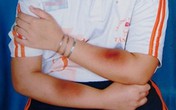 Khi cô trút giận lên đầu trẻ Khi cô trút giận lên đầu trẻ