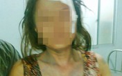 Phó ban Tuyên giáo huyện đánh một phụ nữ gẫy răng Phó ban Tuyên giáo huyện đánh một phụ nữ gẫy răng