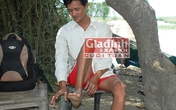 Bí ẩn "người rắn" miền Tây da lột theo mùa, răng không thể mọc Bí ẩn "người rắn" miền Tây da lột theo mùa, răng không thể mọc