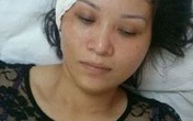 Hải Phòng: Súng công an xã cướp cò làm bạn gái bị thương Hải Phòng: Súng công an xã cướp cò làm bạn gái bị thương