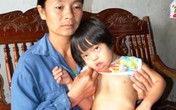 Nhìn con héo mòn vì không có tiền phẫu thuật Nhìn con héo mòn vì không có tiền phẫu thuật