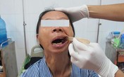 Người phụ nữ 30 năm không há miệng đã phục hồi tốt Người phụ nữ 30 năm không há miệng đã phục hồi tốt