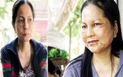 Cô gái “hóa bà lão” vẫn chưa trẻ lại Cô gái “hóa bà lão” vẫn chưa trẻ lại