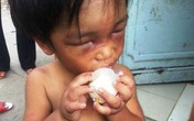 Cháu bé 3 tuổi bị cậu đánh đập dã man, bắt đi ăn xin Cháu bé 3 tuổi bị cậu đánh đập dã man, bắt đi ăn xin