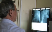 Mục hai khớp háng vì đắp thuốc “lang băm” Mục hai khớp háng vì đắp thuốc “lang băm”