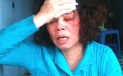 Nghi án 4 cháu gái 'xử' bác chồng theo kiểu côn đồ Nghi án 4 cháu gái 'xử' bác chồng theo kiểu côn đồ