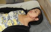 Lâm tặc đánh vỡ đầu nữ giám đốc Cty quản lý bảo vệ rừng Lâm tặc đánh vỡ đầu nữ giám đốc Cty quản lý bảo vệ rừng